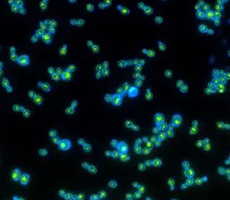 喜歡光的酵母菌——光動(dòng)力酵母菌株